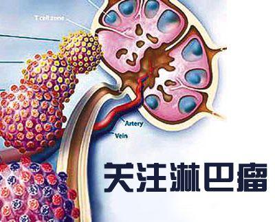 癌症新药(肿瘤特效药120万一针)